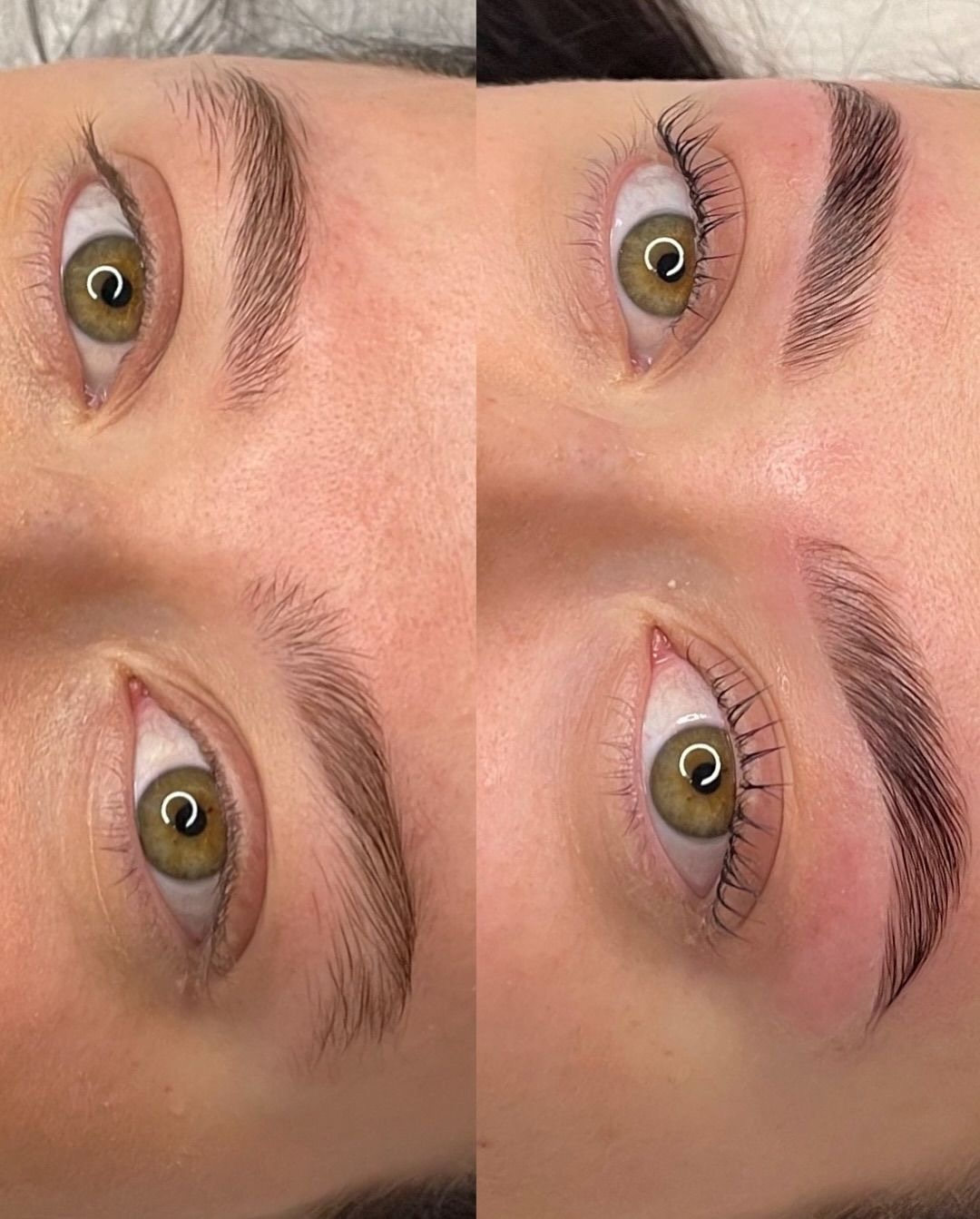 Brow result 11