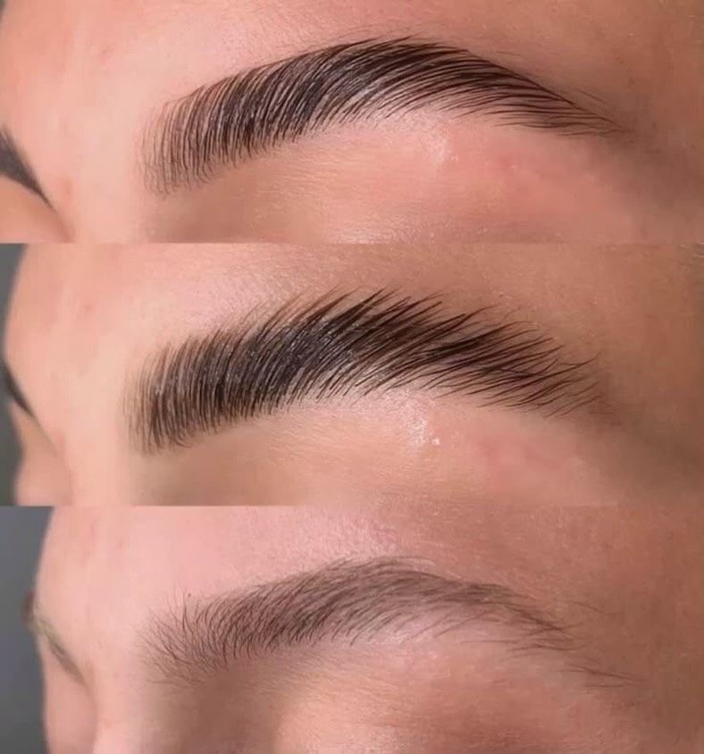 Brow result 12