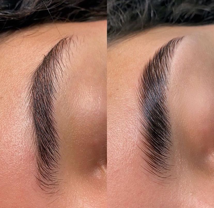 Brow result 13