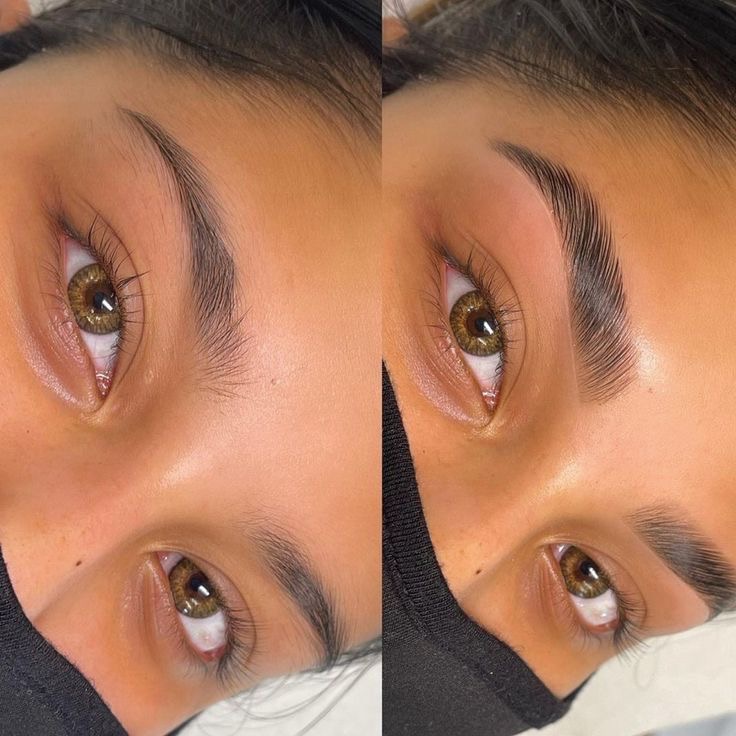 Brow result 5