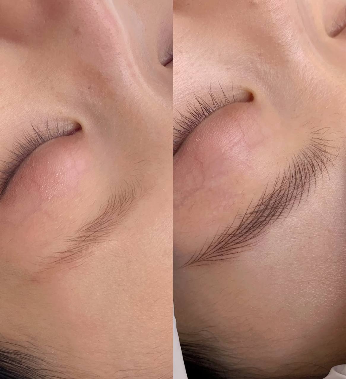 Nano stroke brows result 10