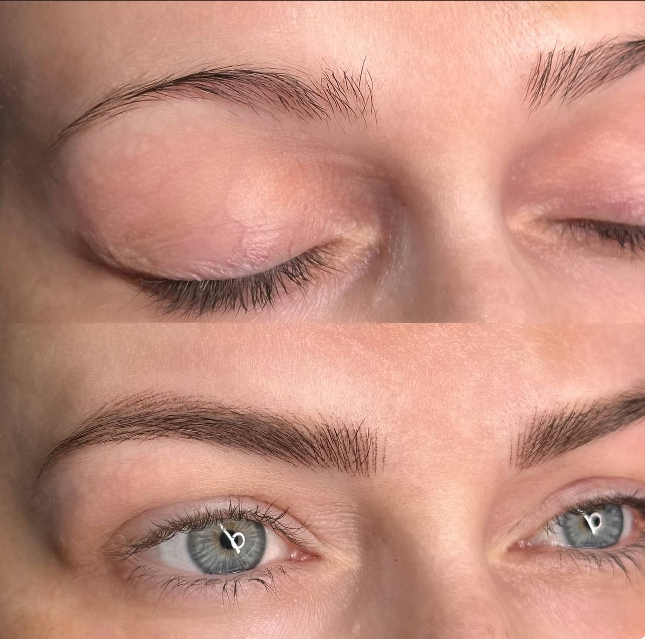 Nano stroke brows result 13