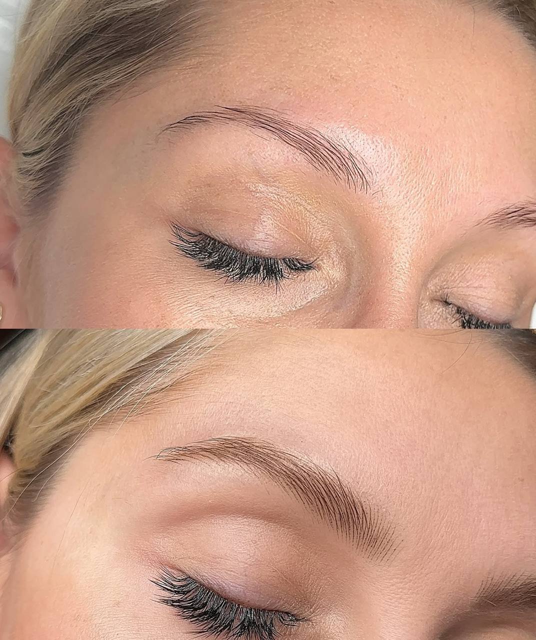Nano stroke brows result 14