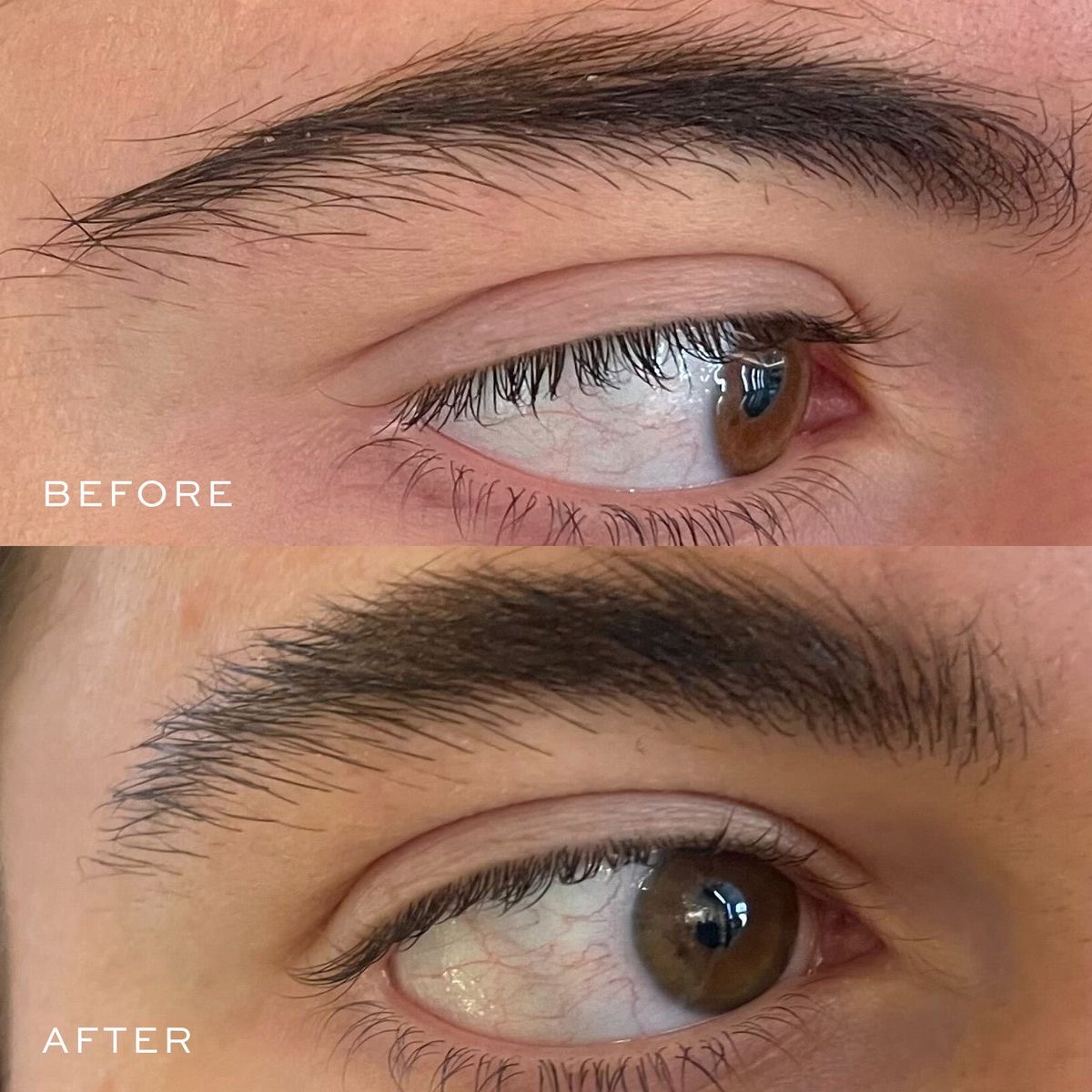 Nano stroke brows result 15