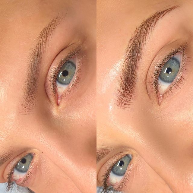 Nano stroke brows result 17