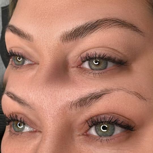 Nano stroke brows result 18