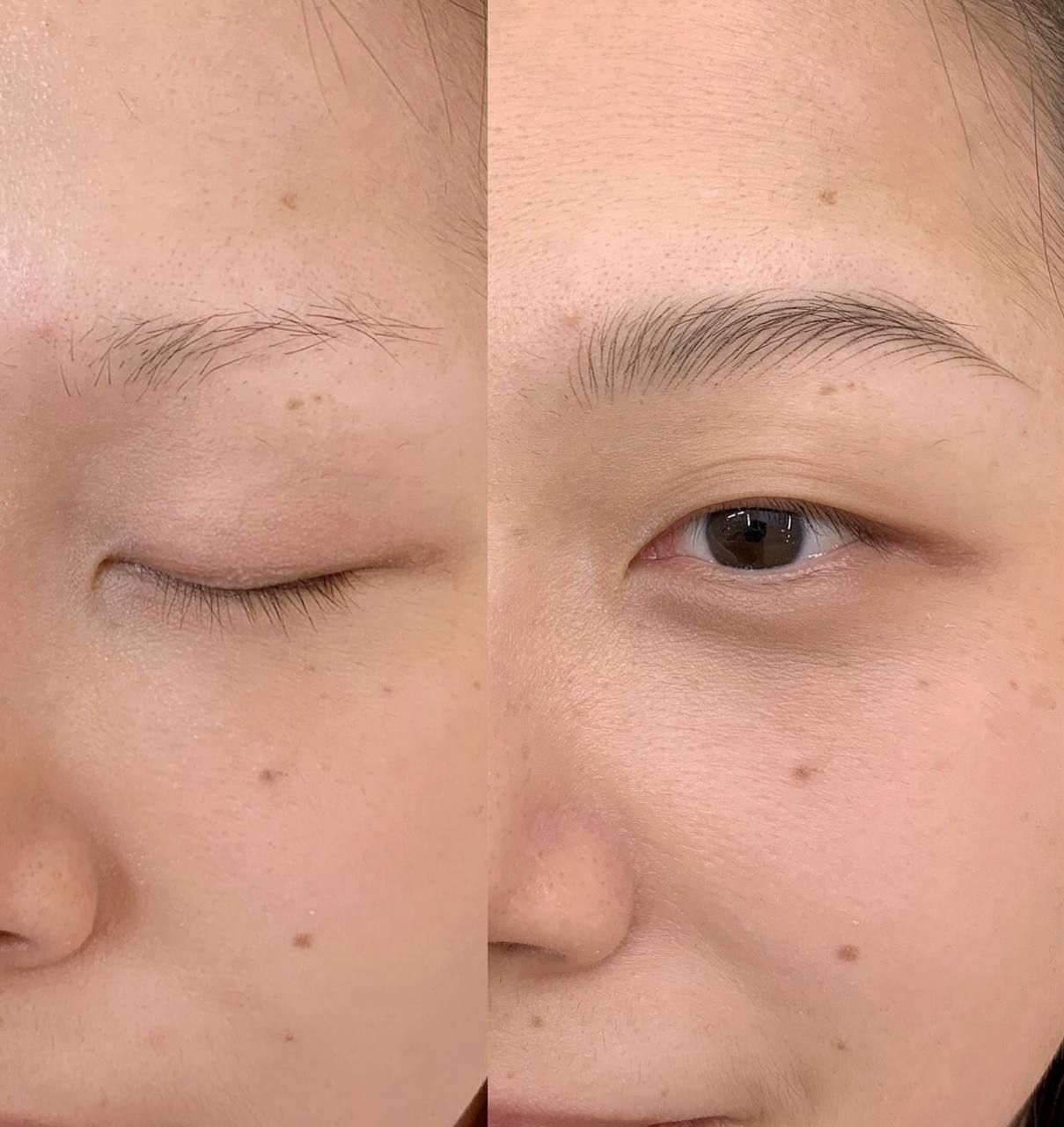 Nano stroke brows result 7