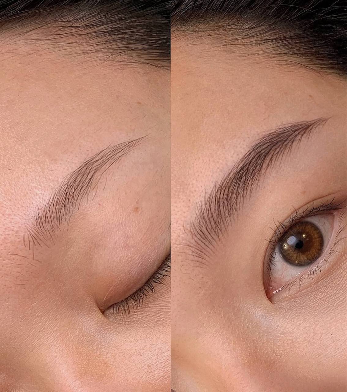 Nano stroke brows result 9